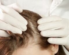 Estudiar la Maestría Internacional en Estética Capilar