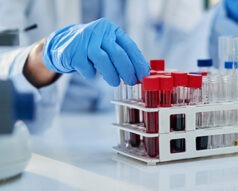 Maestría en Hematología, Banco de Sangre y Genética