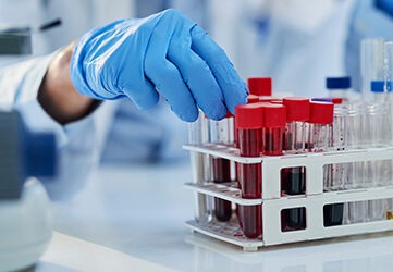 Maestría en Hematología, Banco de Sangre y Genética