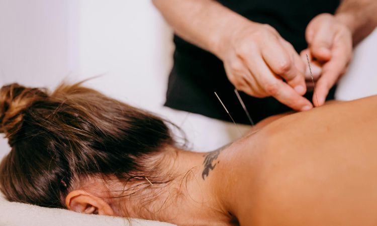 Acupuntura para el estrés: cómo funciona y qué beneficios tiene