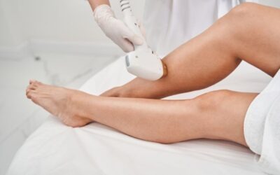 Depilación láser: tipos, ventajas y en qué zonas del cuerpo funciona mejor