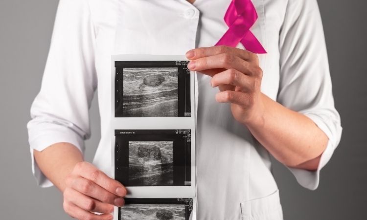 ¿Cómo se hace un diagnóstico de cáncer de mama?