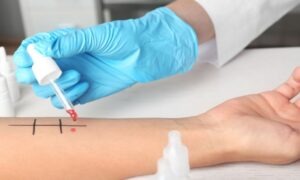 Descubre dónde estudiar alergología