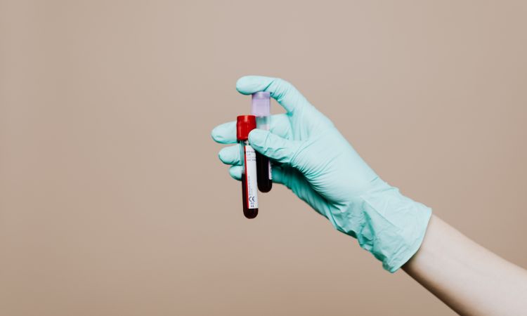 ¿Dónde Estudiar Hematología? El Primer Paso En Tu Formación