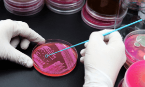 Conoce la importancia de la microbiología