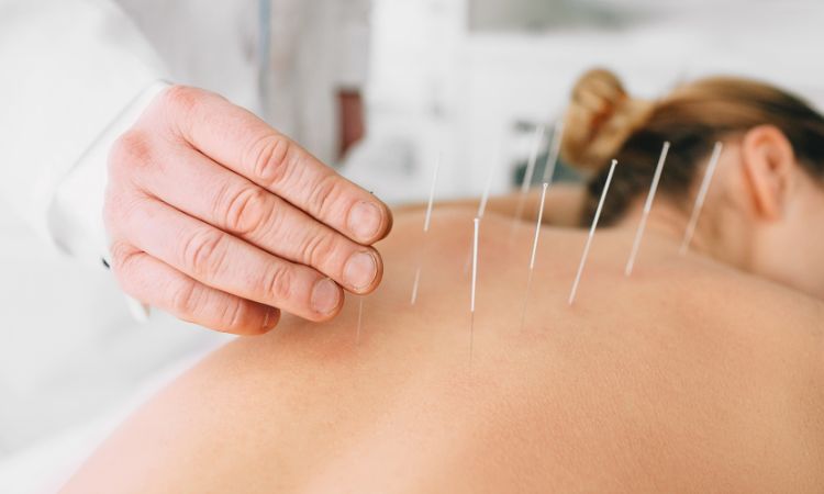 Descubre para qué sirve la acupuntura en la espalda